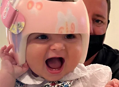 Does My Baby Have Congenital Torticollis? – Hope AMC Center - Dubai