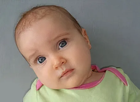 How Do I Know If My Baby Has Torticollis? – Hope Abilitation Medical Center -Dubai