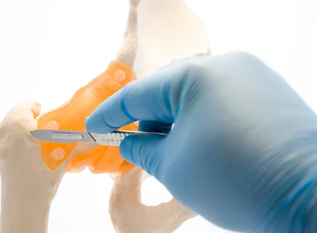 Need The Best Pediatric Orthopedic Oncology Therapy in Dubai? – Hope Abilitation Medical Center
