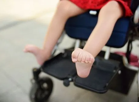 Pediatric Orthotics & Prosthetics Can Help Your Child Regain Their Lifestyle