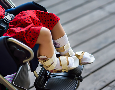 Pediatric Prosthetics: Special Considerations for Children