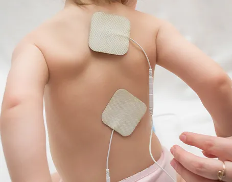 Electrical Stimulation for Children with Spina Bifida and Cerebral Palsy: A Ray of Hope for Parents