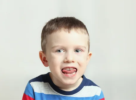 The Best Ways to Use Prompts & Causes in Speech Therapy – Hope Abilitation Medical Center