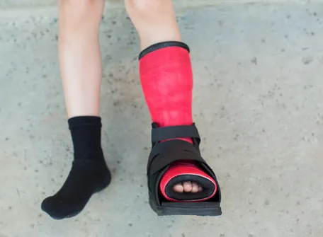 Using Ankle-Foot Orthotics with Cerebral Palsy Children- Hope-AMC- Dubai