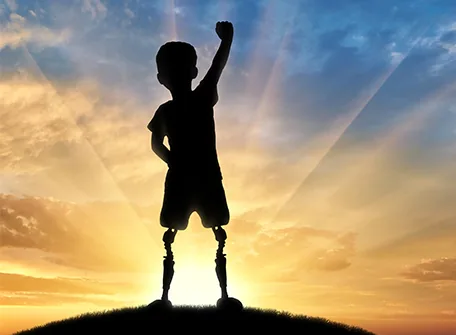 What Are the Benefits of Prosthetics for Children? – Hope Abilitation Medical Center
