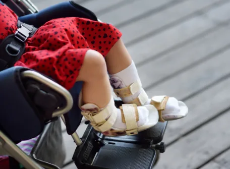 What is Ankle Foot Orthosis? How Does A Knee Ankle Foot Orthosis Help Your Child?