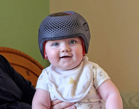 When a Tiny Head Tells a Big Story: Understanding Head Deformities and Head Turn Preferences in Babies