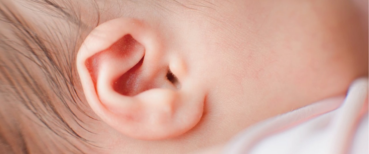 Non-surgical Ear Reshaping Treatment for Infants in Dubai