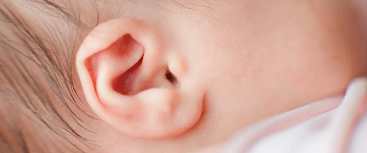 Non-surgical Ear Reshaping Treatment for Infants in Dubai