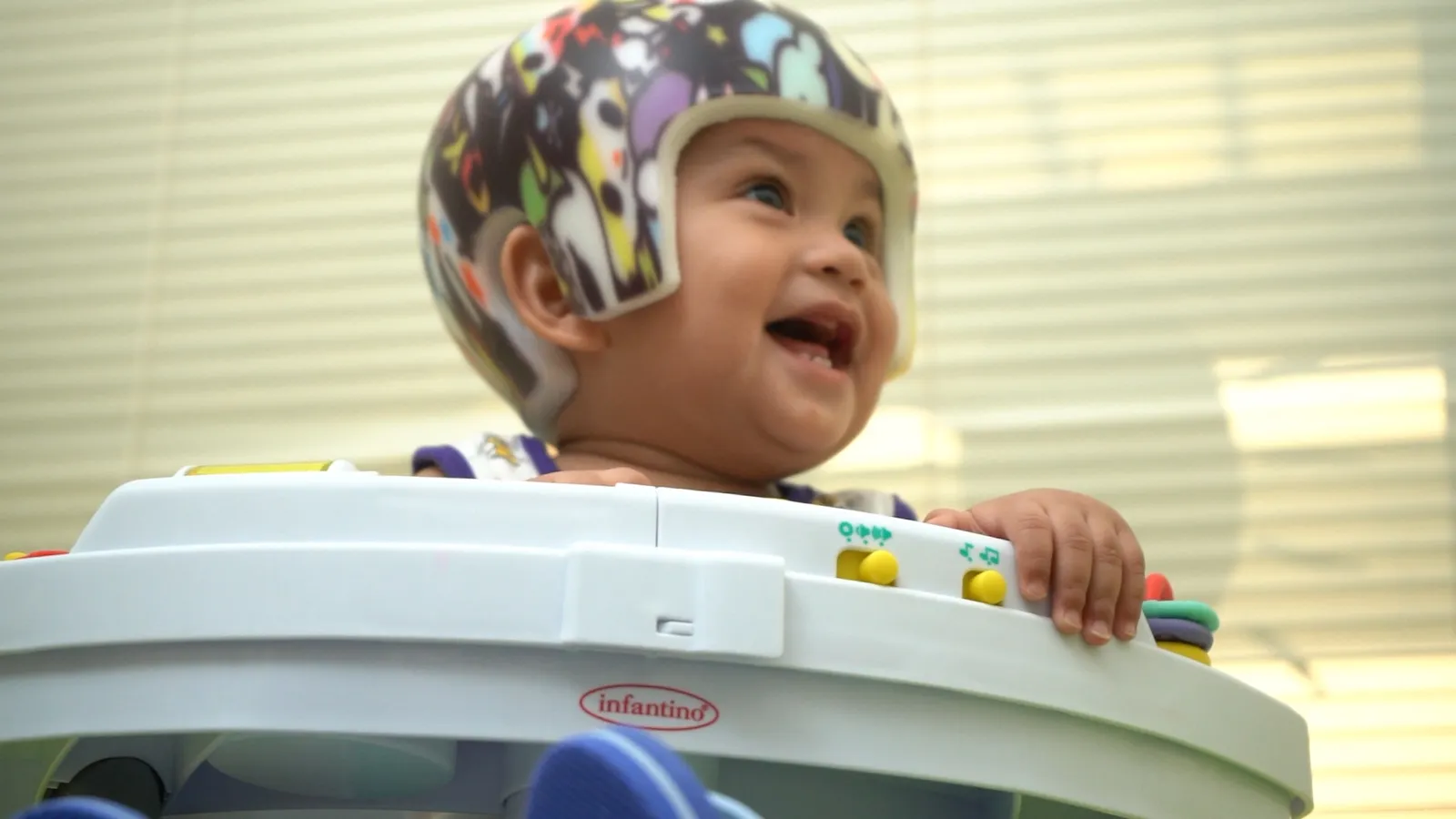 A smiling baby wears a cranial helmet