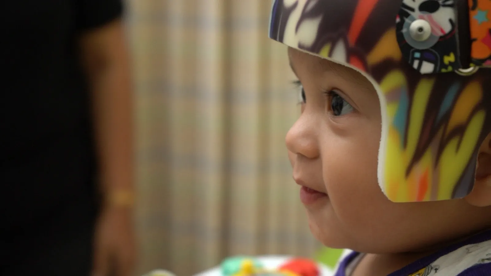 A baby wearing a cranial helmet, seen from the side