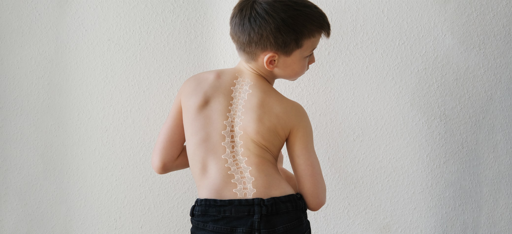 Scoliosis Therapy