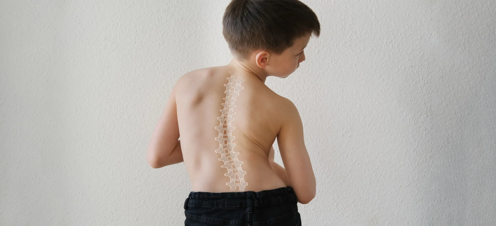 Scoliosis Therapy