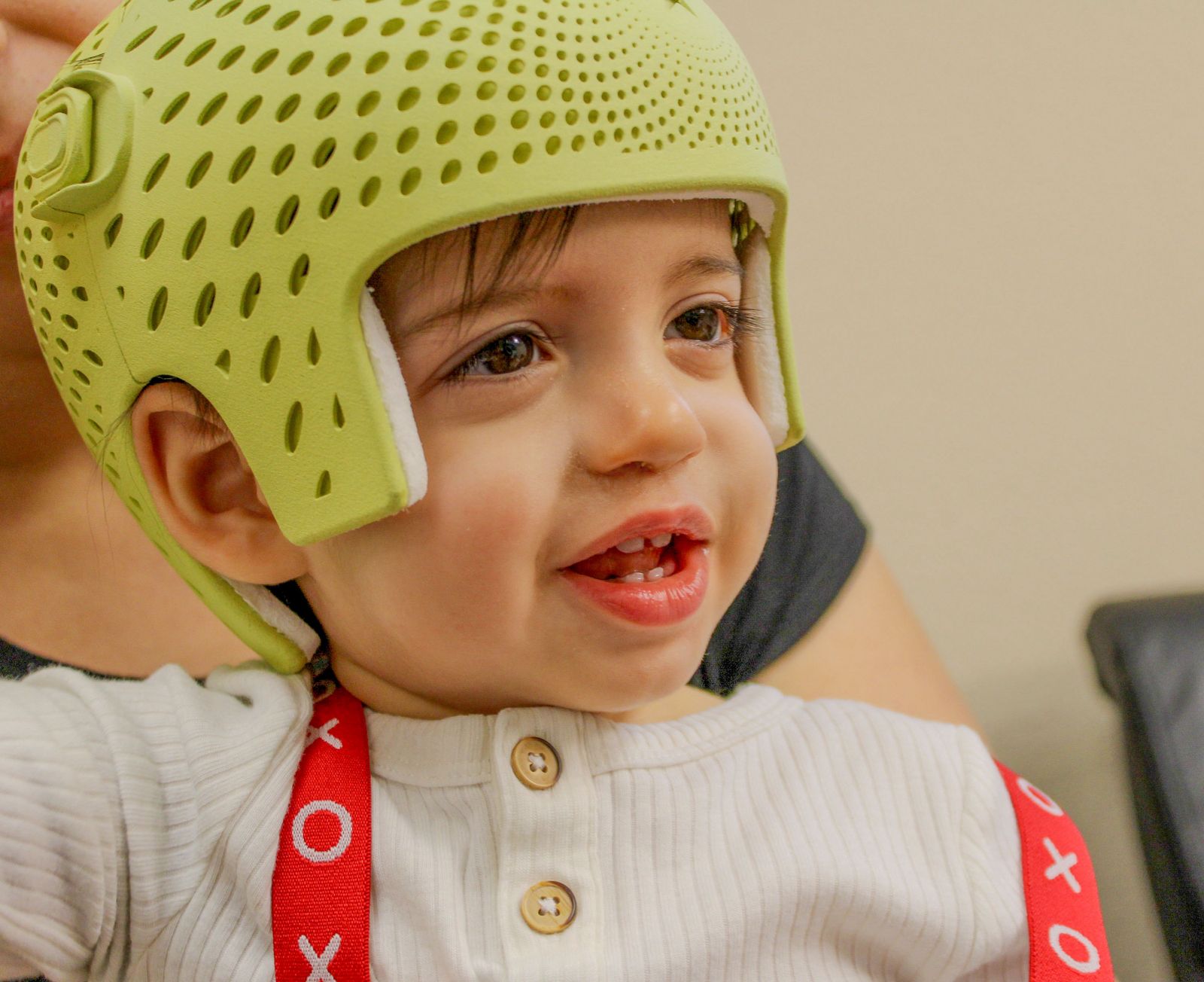 Helmet Therapy process image