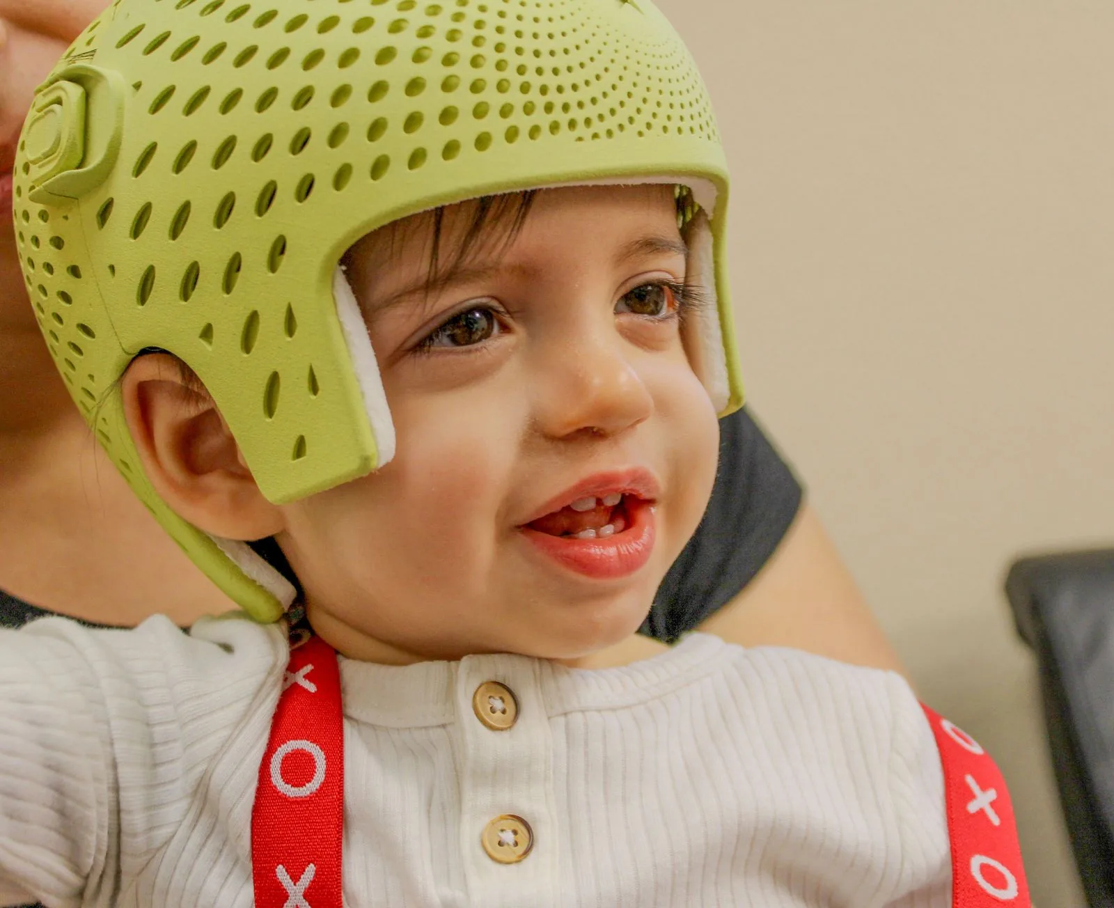 Helmet Therapy process image