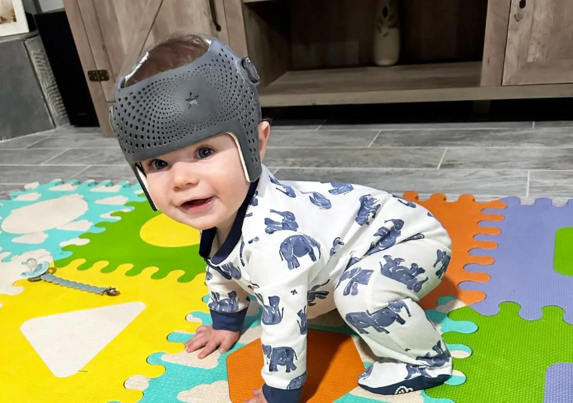Key factors that affect your baby’s head shape image
