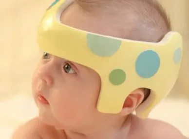 Helmet Therapy precautions image